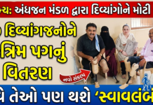 ભરૂચમાં અંધજન મંડળ દ્વારા 30 દિવ્યાંગજનોને કૃત્રિમ પગનું વિતરણ કરાયું